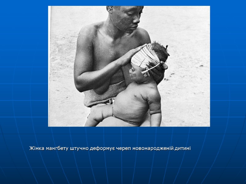 Жінка мангбету штучно деформує череп новонародженій дитині